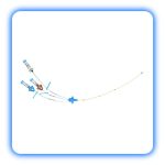 کاتتر cvc همودیالیز