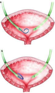 سوند دبل جی