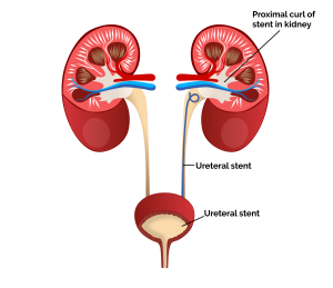 سوند دبل جی