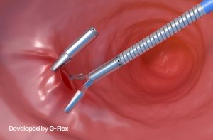 هموکلیپس لاپاروسکوپی