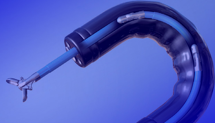 هموکلیپس لاپاروسکوپی