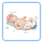 شنت مغزی - Image 2