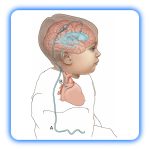 شنت مغزی - Image 3