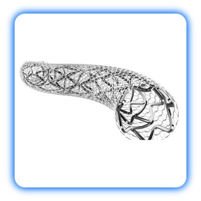 استنت کاروتید