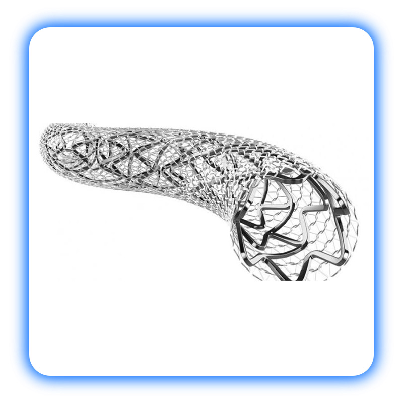 استنت کاروتید